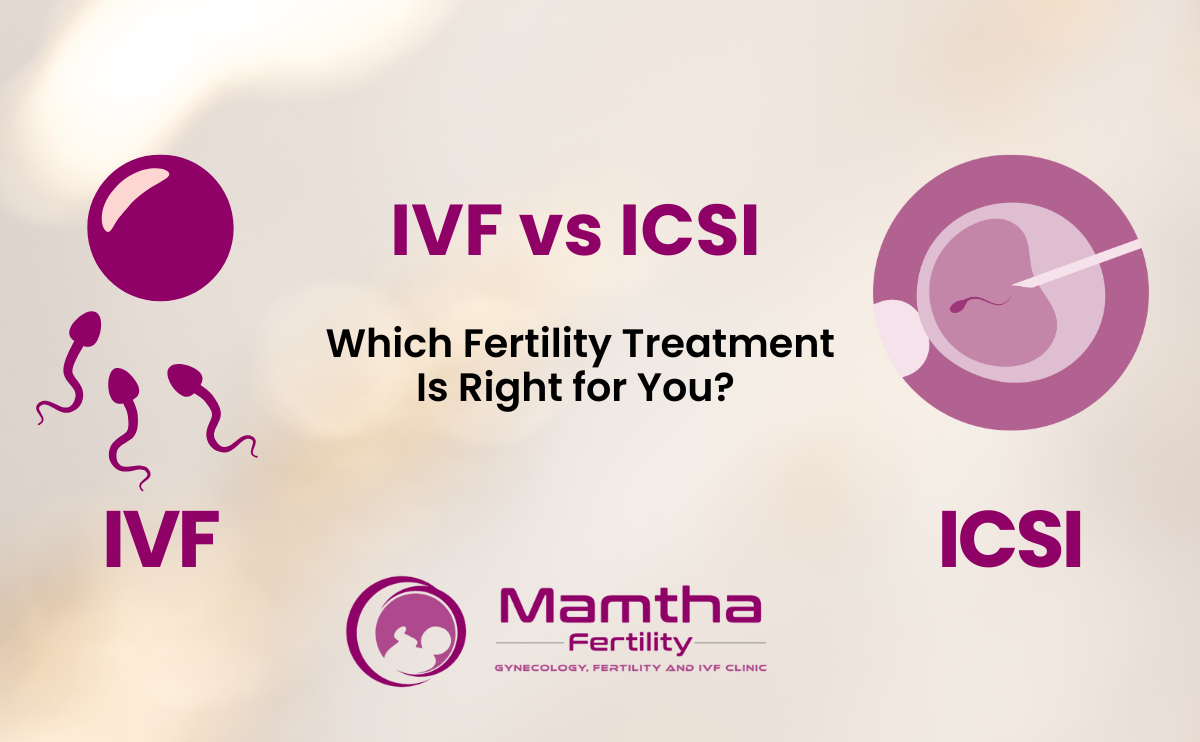 IVF vs ICSI